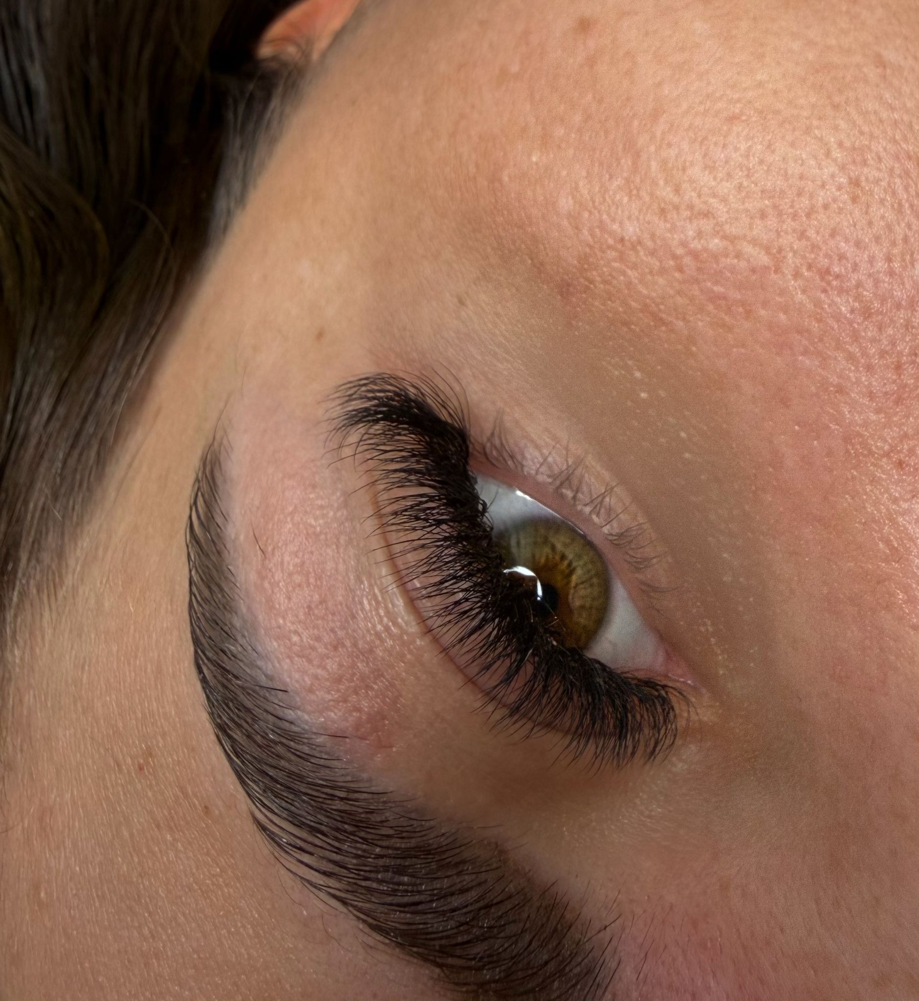 Volumen Neumodellage